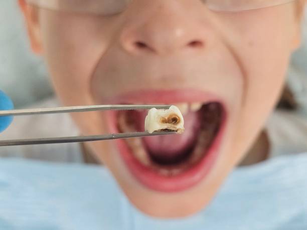 Best Emergency Pediatric Dental Care in Mount Vernon, IN
