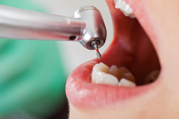Professional Emergency Dental Service in IN